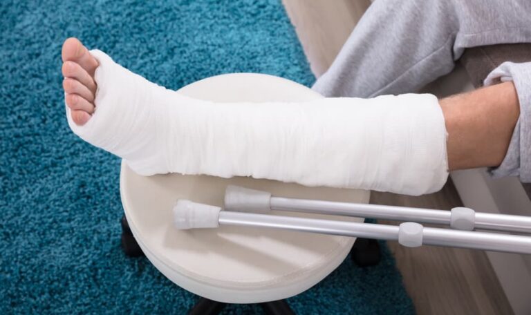 Person with broken leg in cast and crutches after auto accident representing fracture injury claims in New York