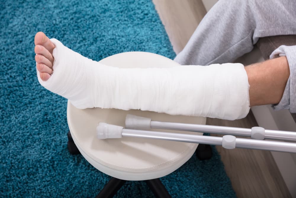 Person with broken leg in cast and crutches after auto accident representing fracture injury claims in New York